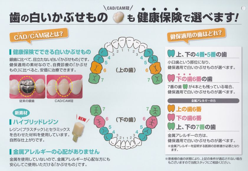 保険 適用 の 白い 歯