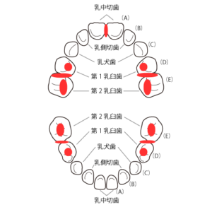 乳歯の虫歯になりやすい場所
